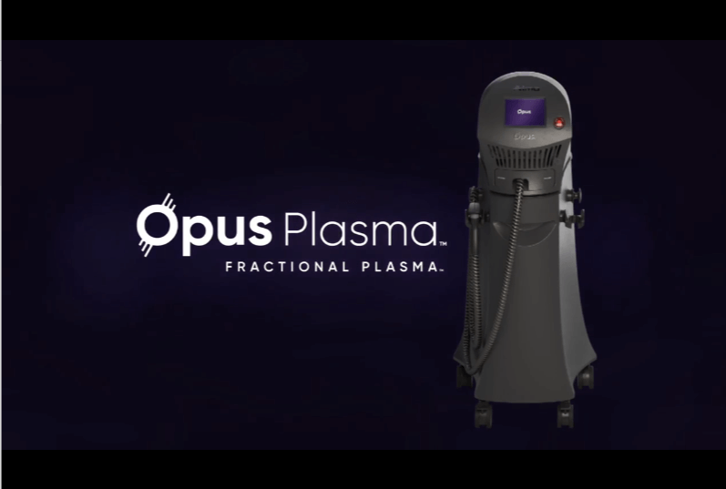  Opus watts and plasma