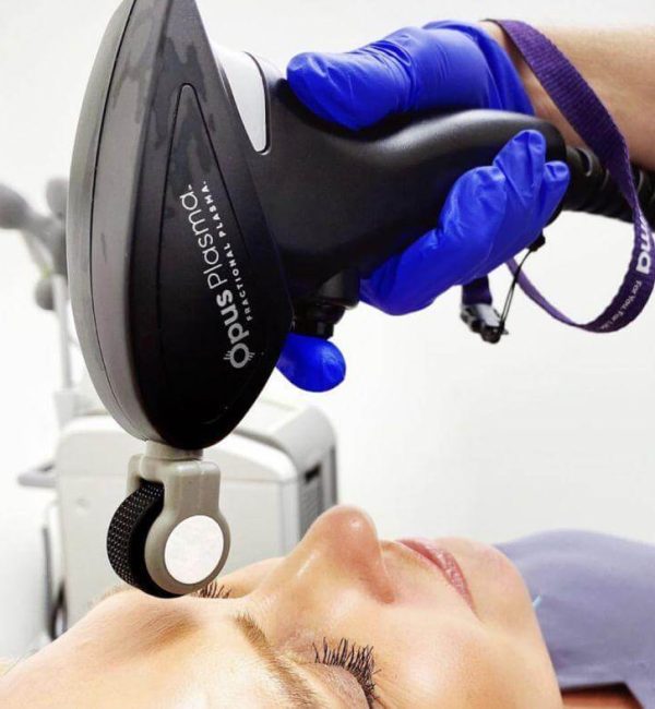 Woman Receiving Opus Plasma Laser Treatment | Estevez Aesthetics in Las Vegas, NV